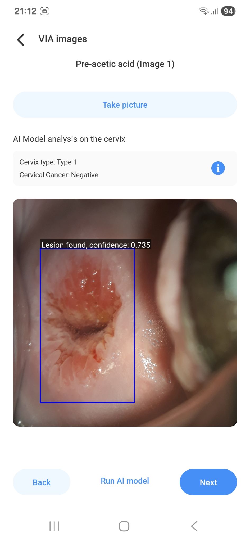 An Open-source Private Health Information Exchange system for cancer screening in low resource settings image 5